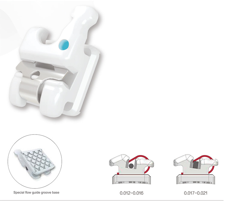 OR205   Interactive Self-Ligating Ceramic Bracket